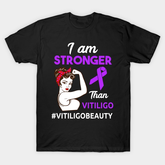 Vitiligo Awareness design T-Shirt by KuTees